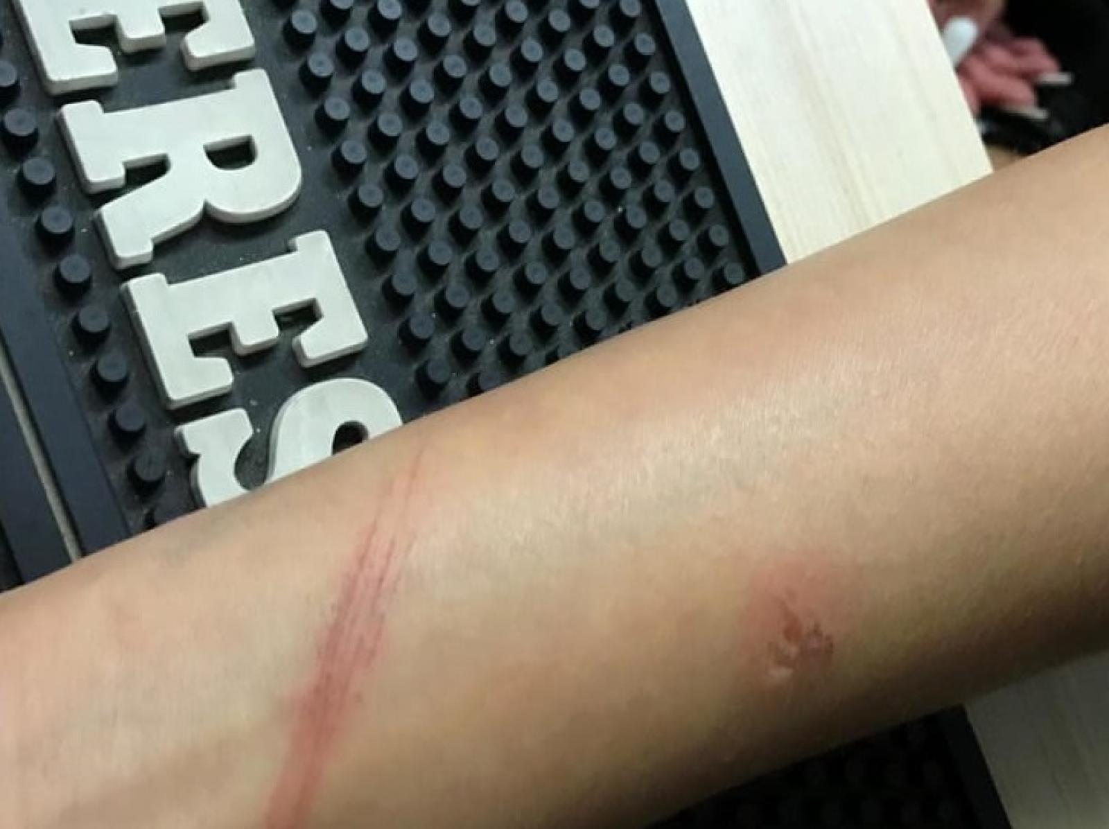 Tentato stupro alle giostre. L'aggressore rischia il linciaggio 