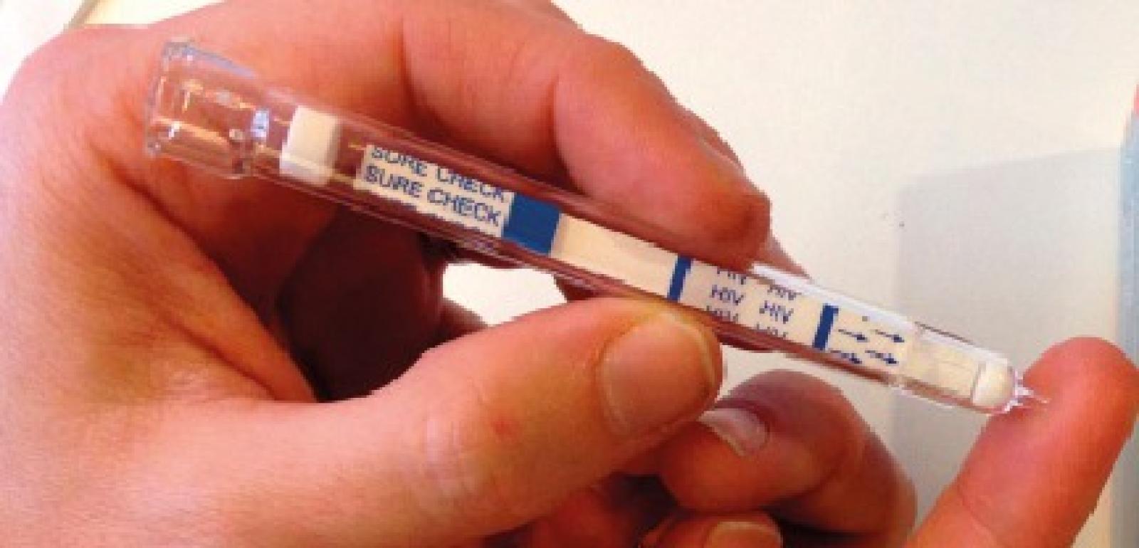 La compagna gli nasconde che ha l&rsquo;Hiv, lui lo scopre dopo 7 anni e la denuncia