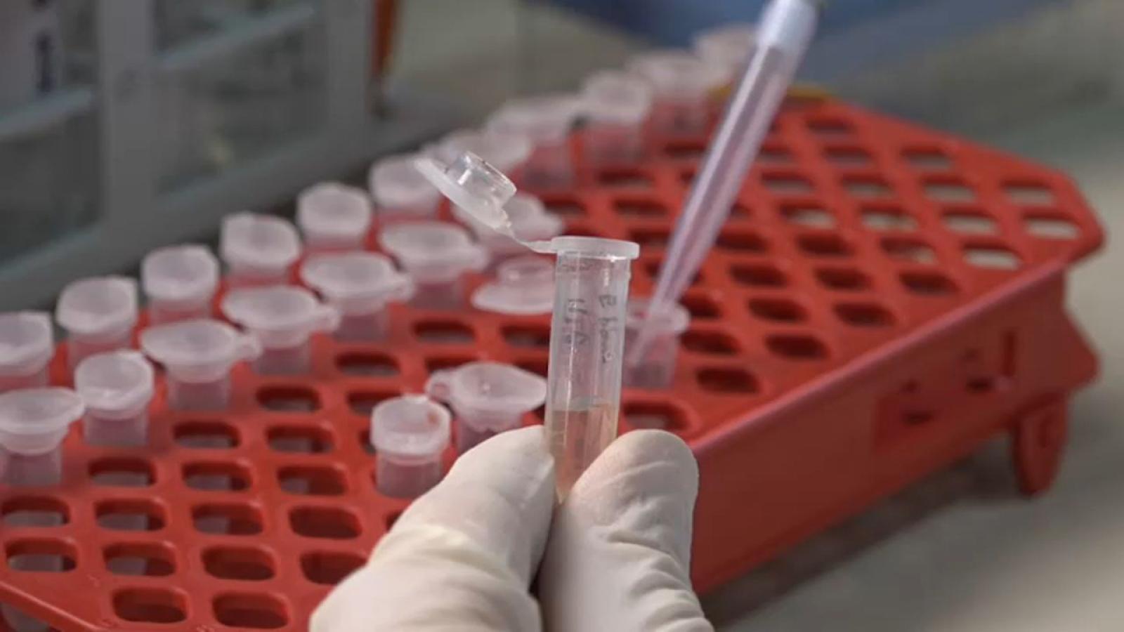 Malaria, cavarzerano ricoverato a malattie infettive