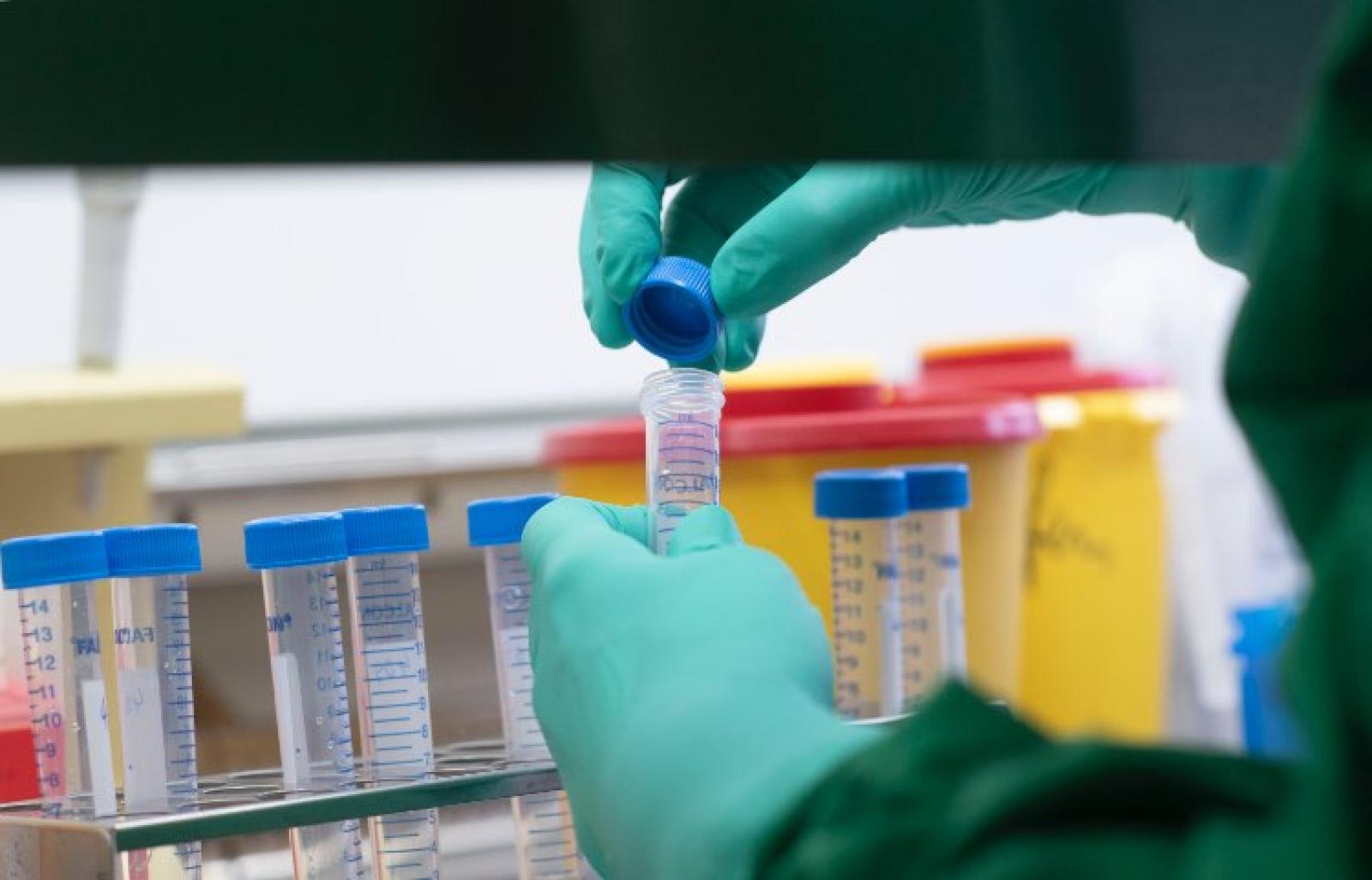 Coronavirus, 3 decessi e 43 nuovi contagiati