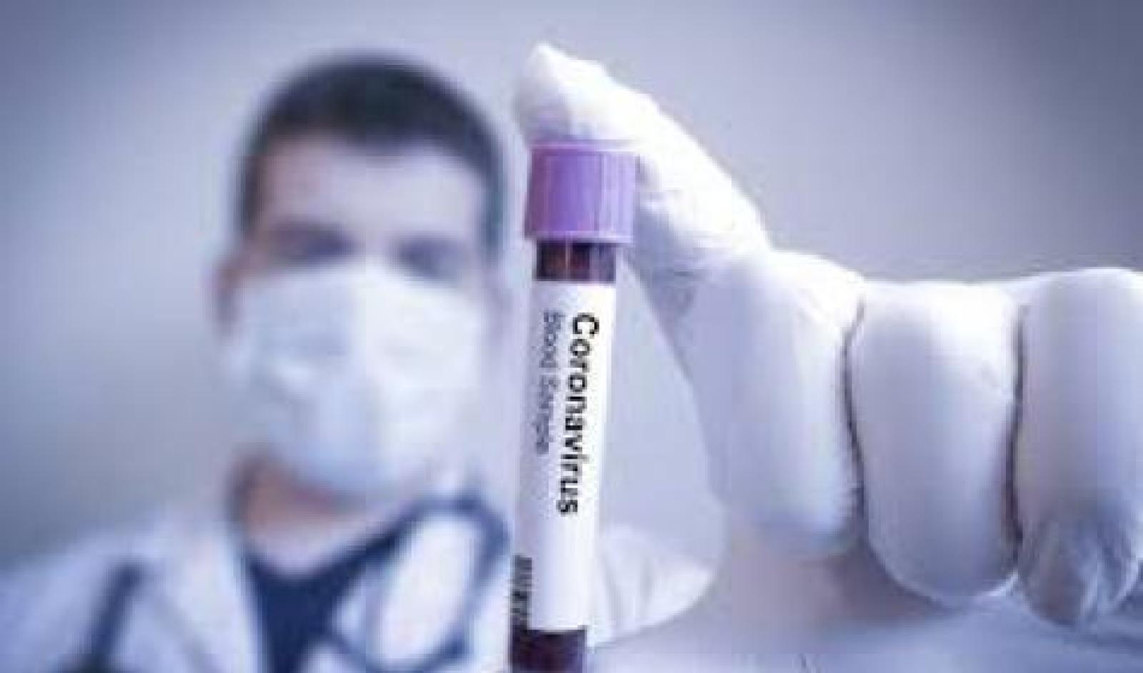 Coronavirus, altri 18 casi: in Veneto siamo a 291
