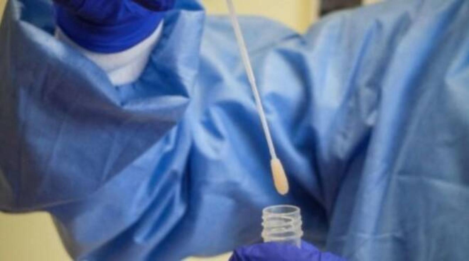 Coronavirus: Zaia, pochi tamponi disponibili. Ce li faremo da soli