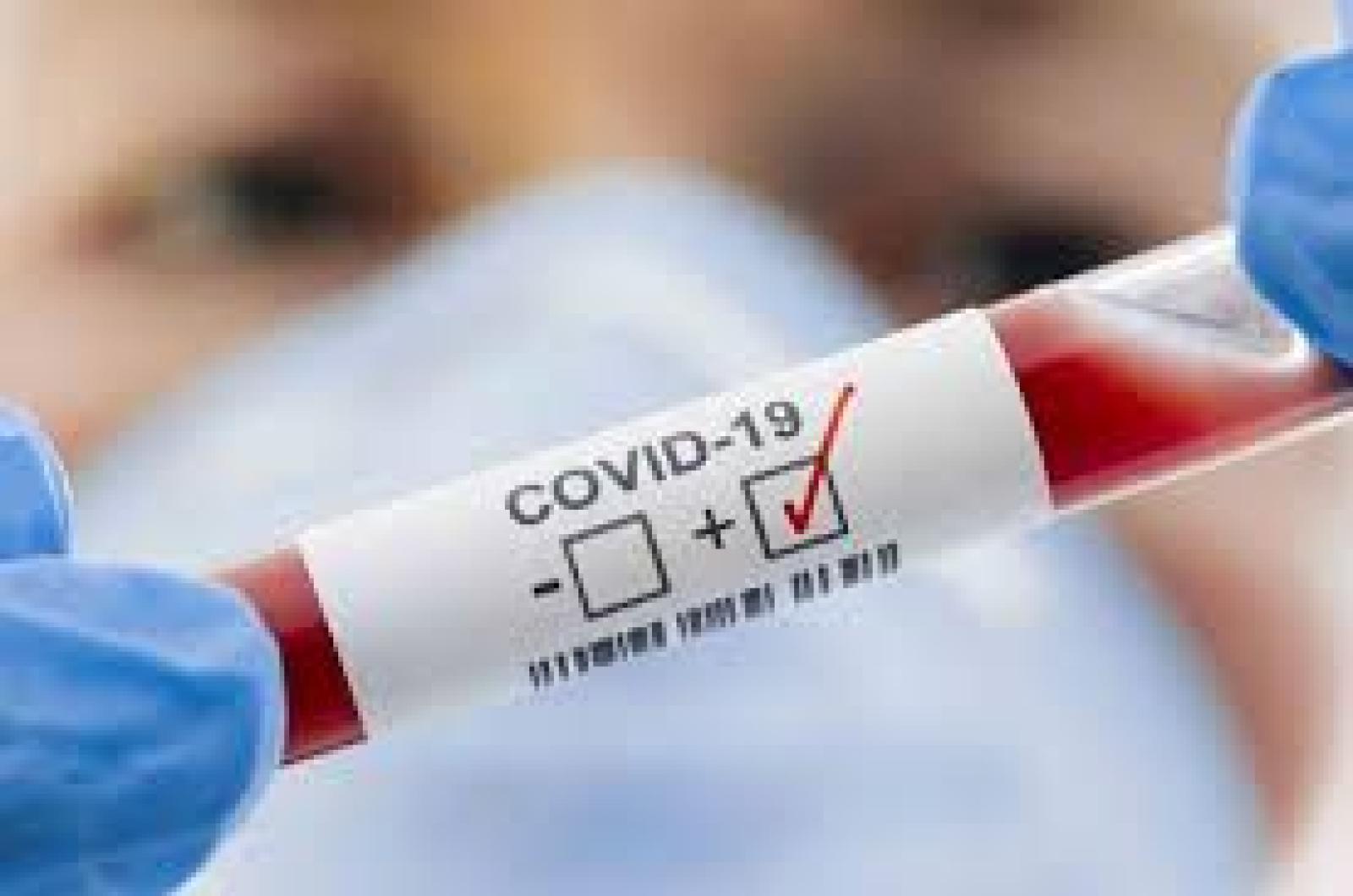 Coronavirus: "Tra una settimana, prima trasfusione di plasma immunizzato"