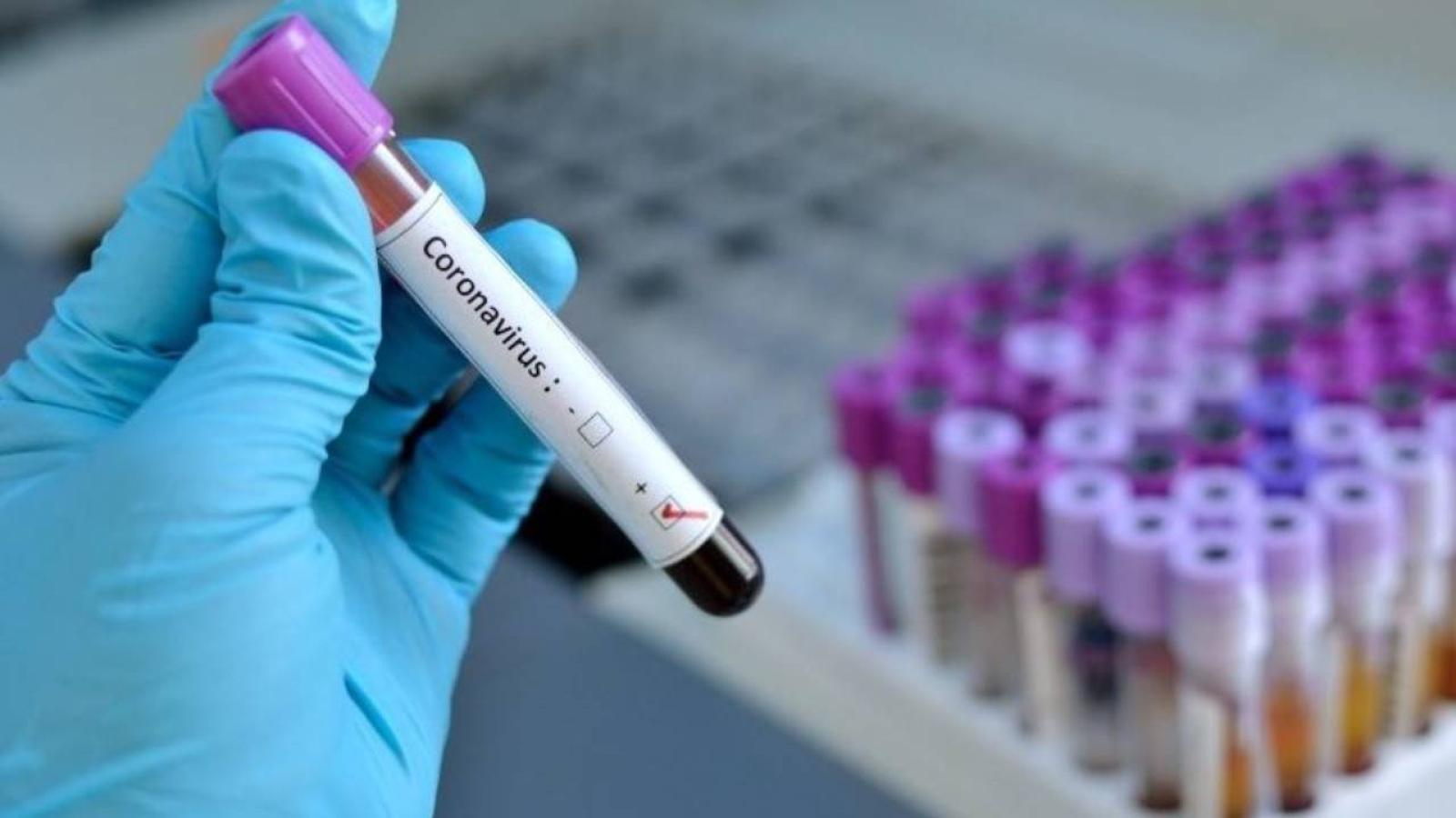 Coronavirus: "Tra una settimana, prima trasfusione di plasma immunizzato"