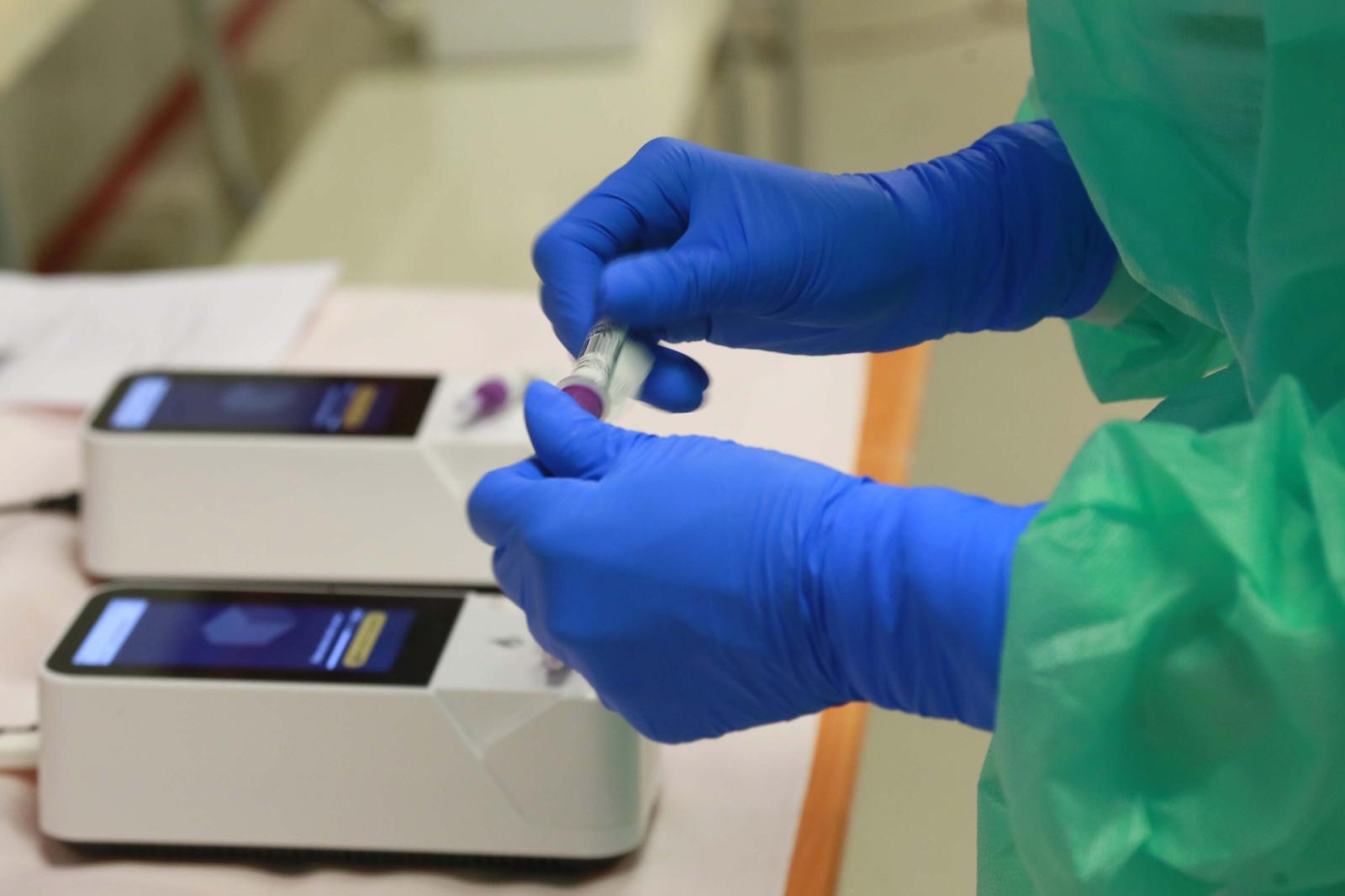 La Procura del Veneto indaga sui test rapidi