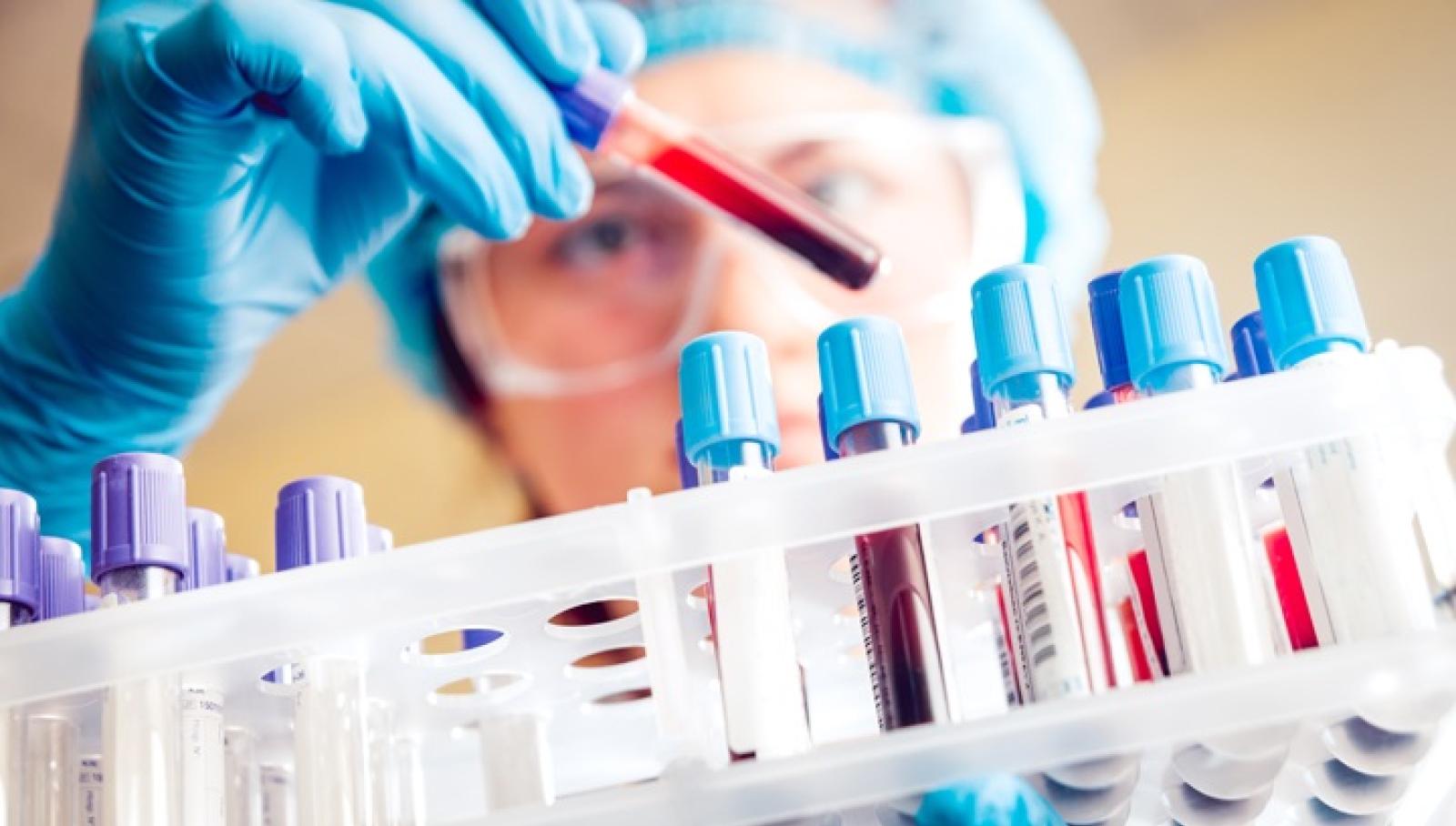 Chi ha battuto la malaria &egrave; pi&ugrave; resistente al virus