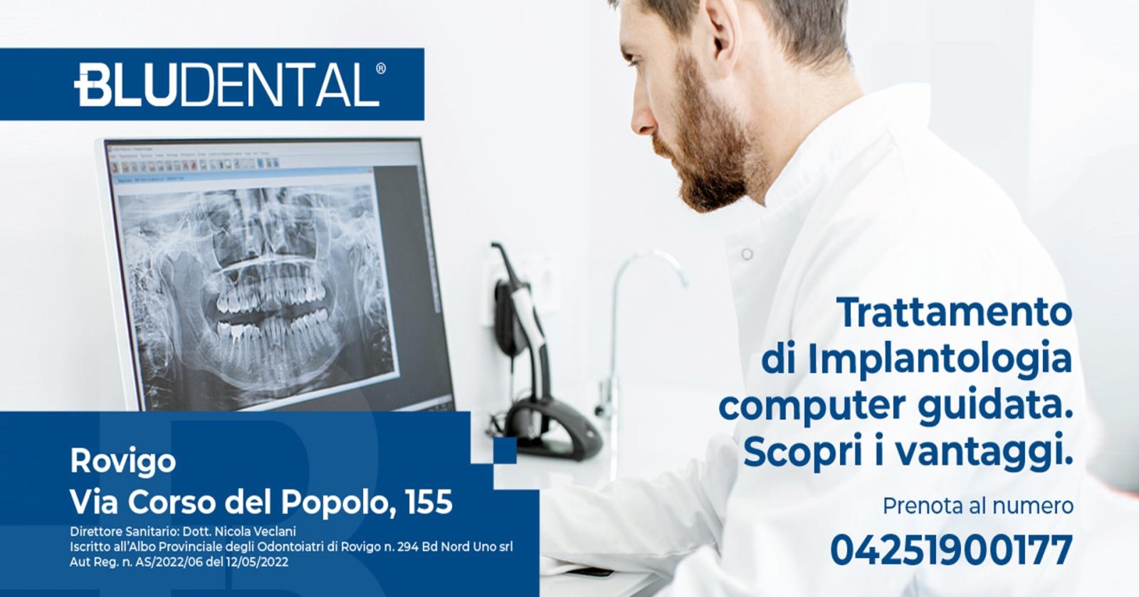 Implantologia computer guidata - la tecnologia a servizio del benessere