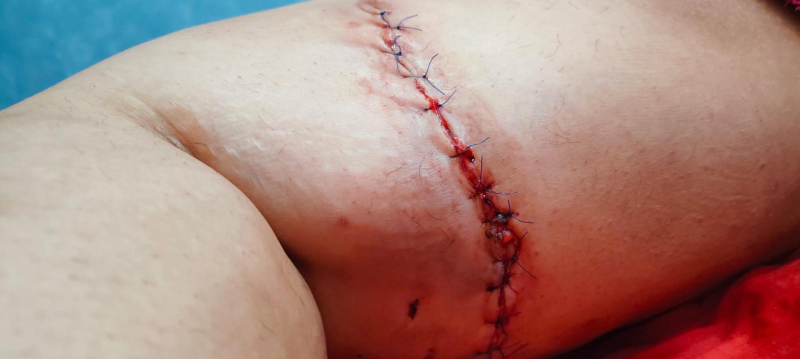 Sbranata dai cani, rimproverata dalla loro padrona