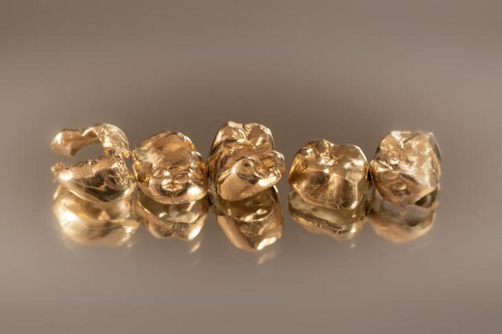 Rubava i denti in oro ai morti