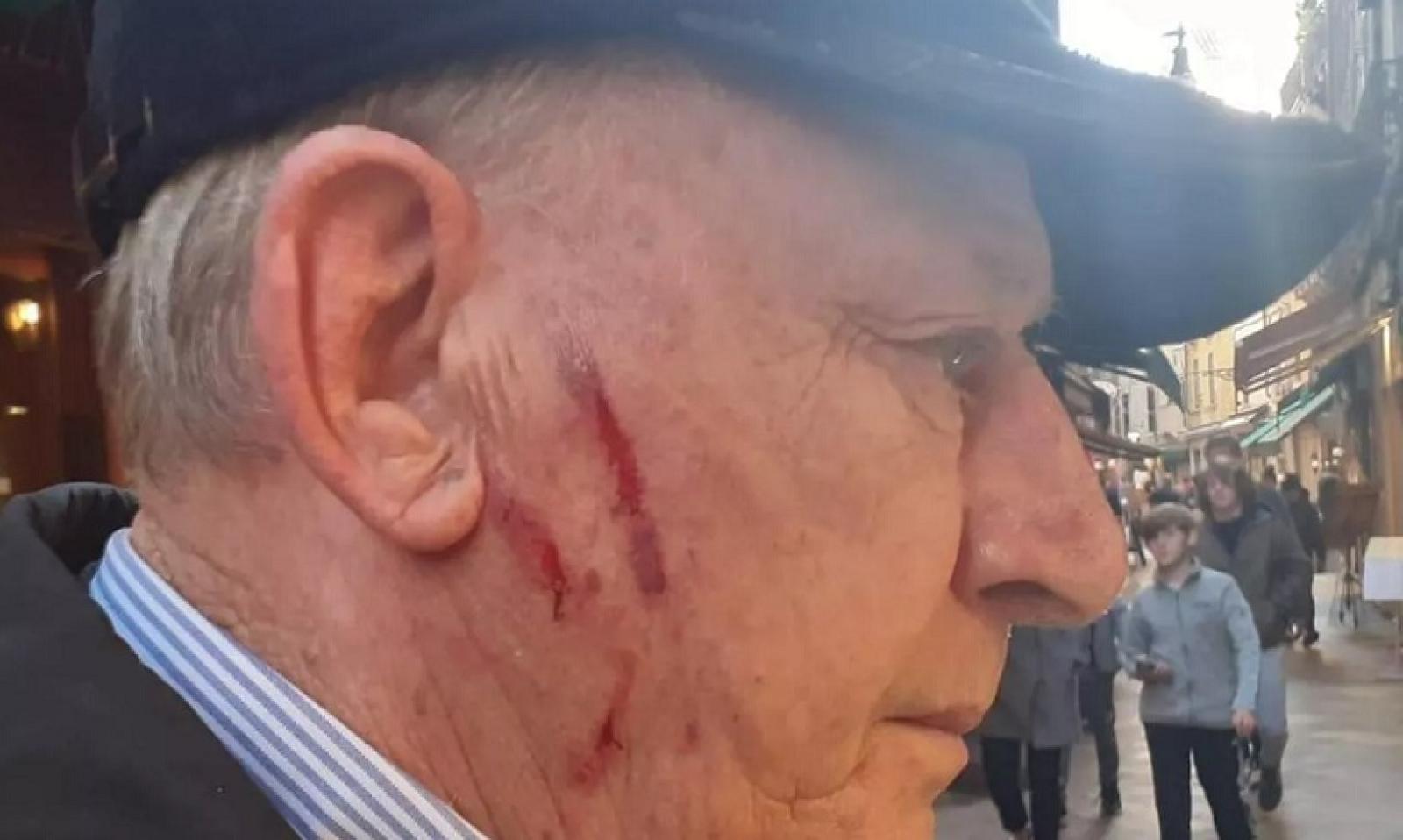 Sventa il furto, aggredito e ferito dalle giovani ladri