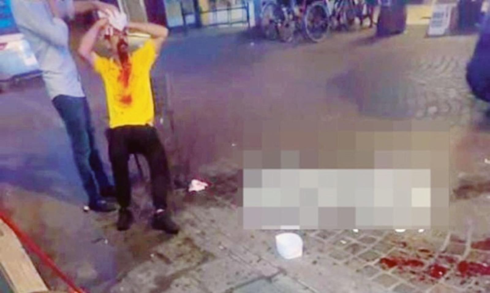 Sfregiato a bottigliate: &ldquo;Ora ho paura&rdquo;