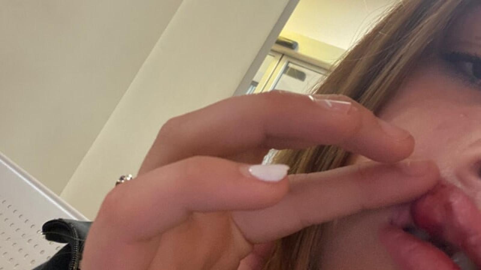 Aggressione a Noventa Padovana: una sigaretta scatena la violenza tra adolescenti