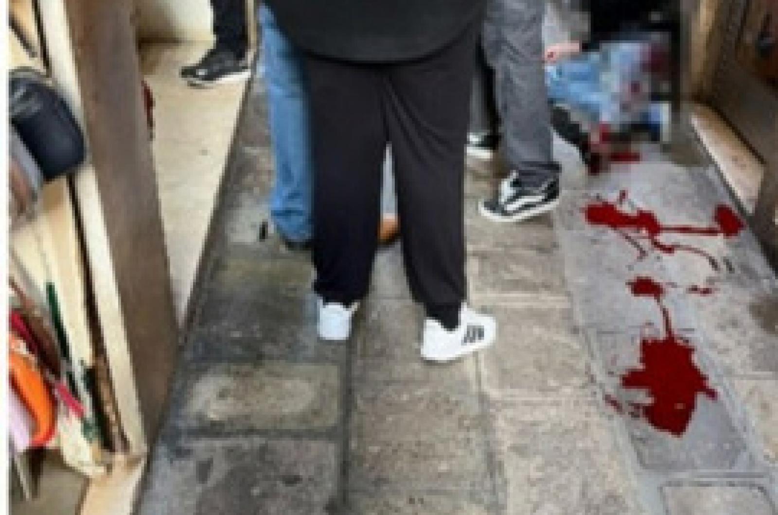 Accoltellamento a Cannaregio: un enigma tra le calli di Venezia