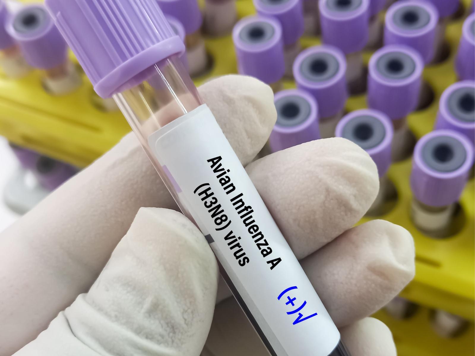 Sviluppato dall'Universit&agrave; di Buffalo offre protezione completa nei test sui topi