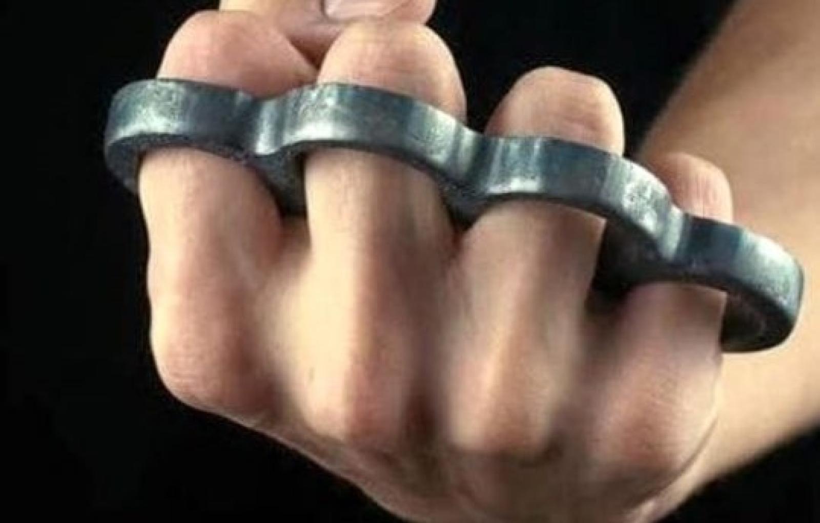 Aggressione brutale a Treviso: pensionato ferito gravemente da un ladro