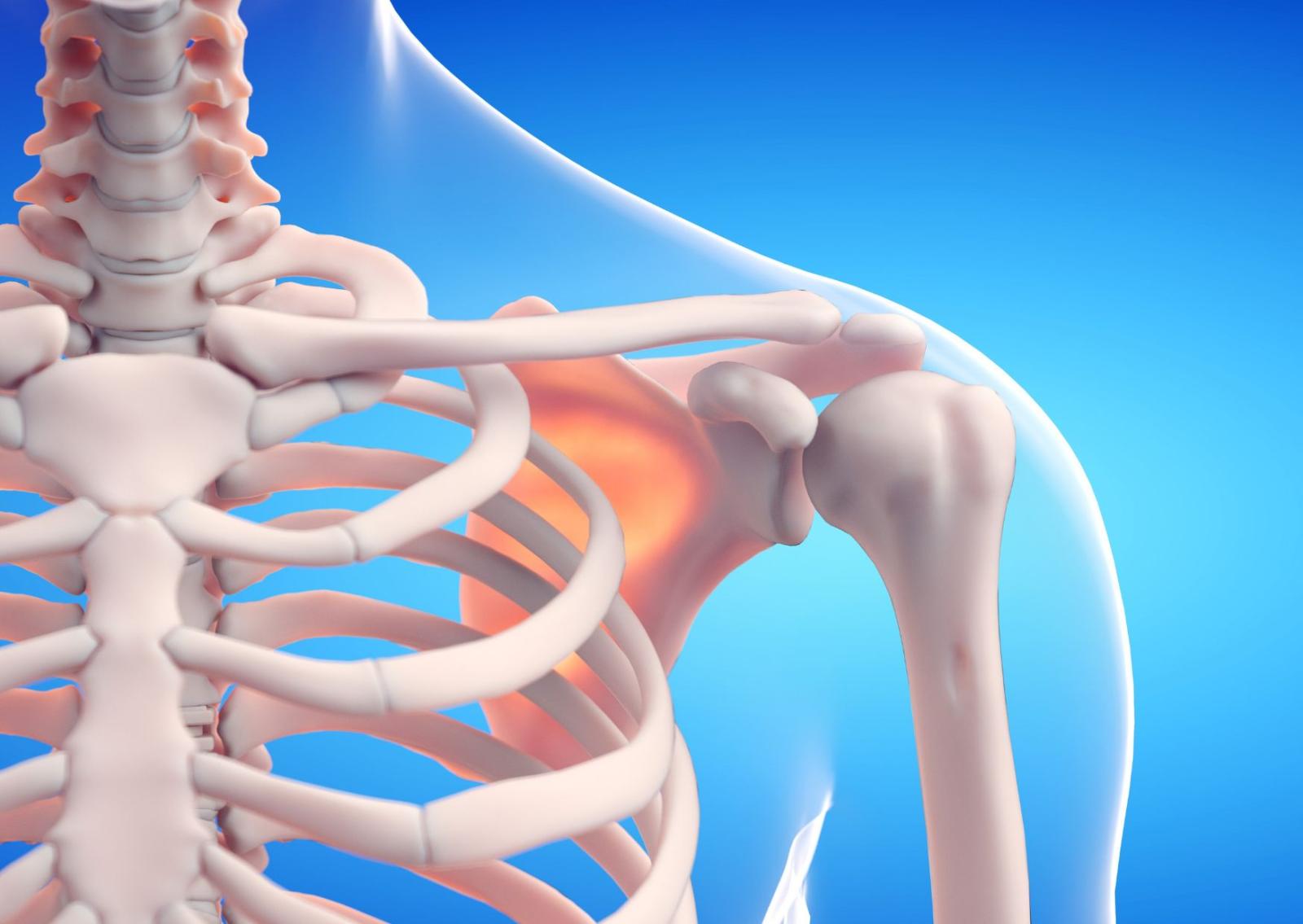 Frattura ossea? Basta la colla a caldo