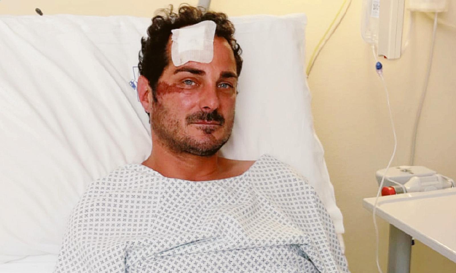 Indagato per lesioni e omissione