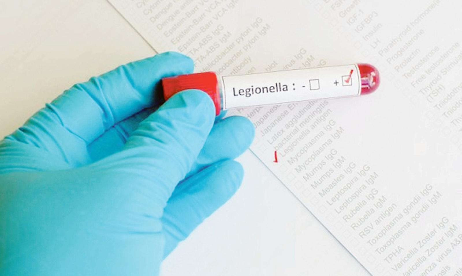 Legionella, tubature sotto accusa