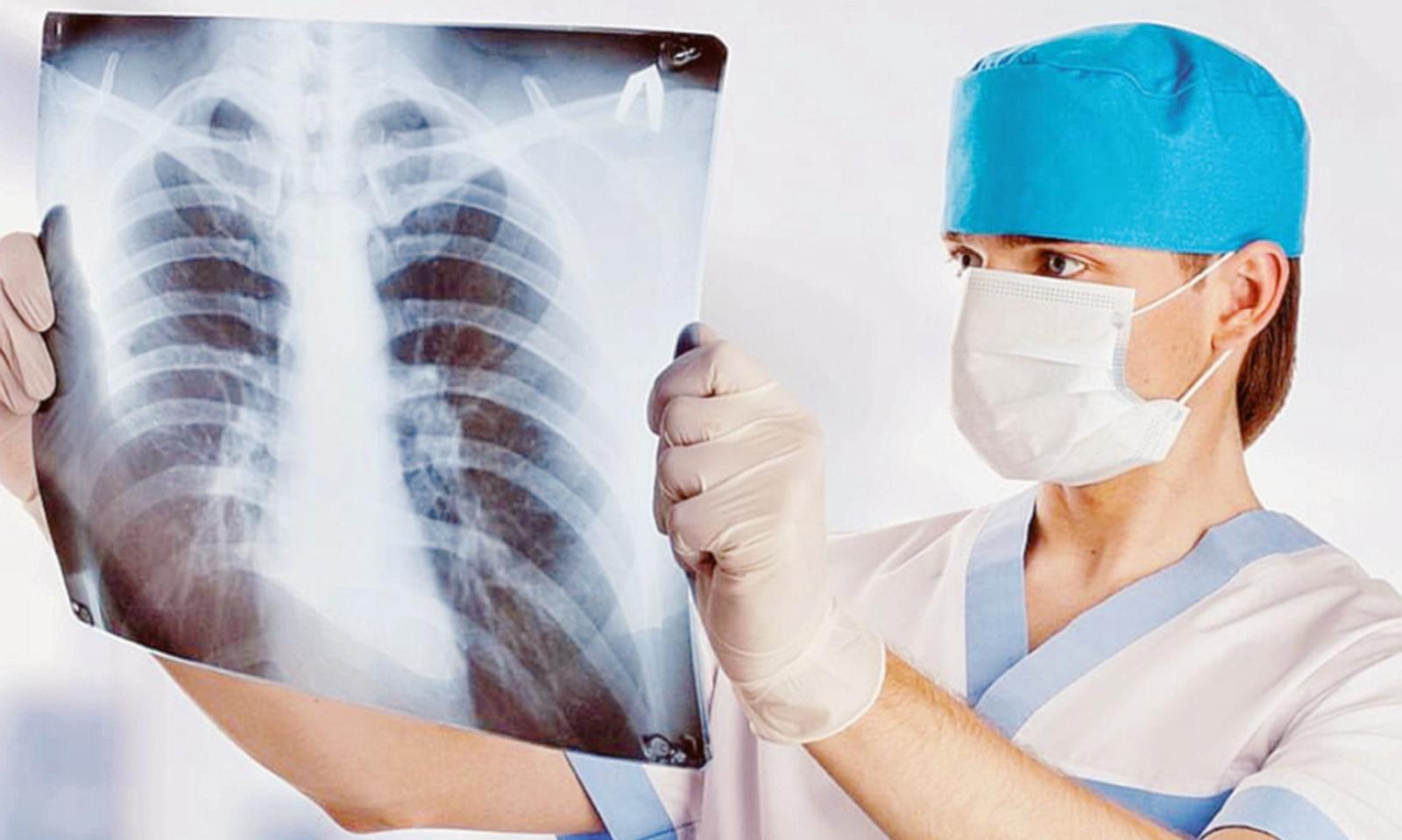 Fratture ignorate: &ldquo;Valuteremo&rdquo;