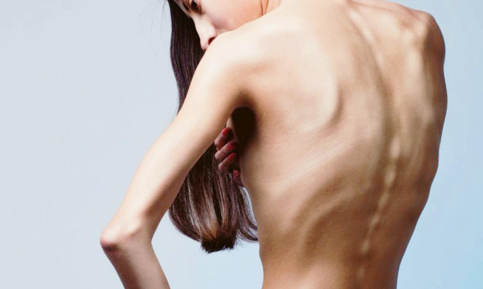 &ldquo;Peso 27 chili, ma io mi piaccio&rdquo;