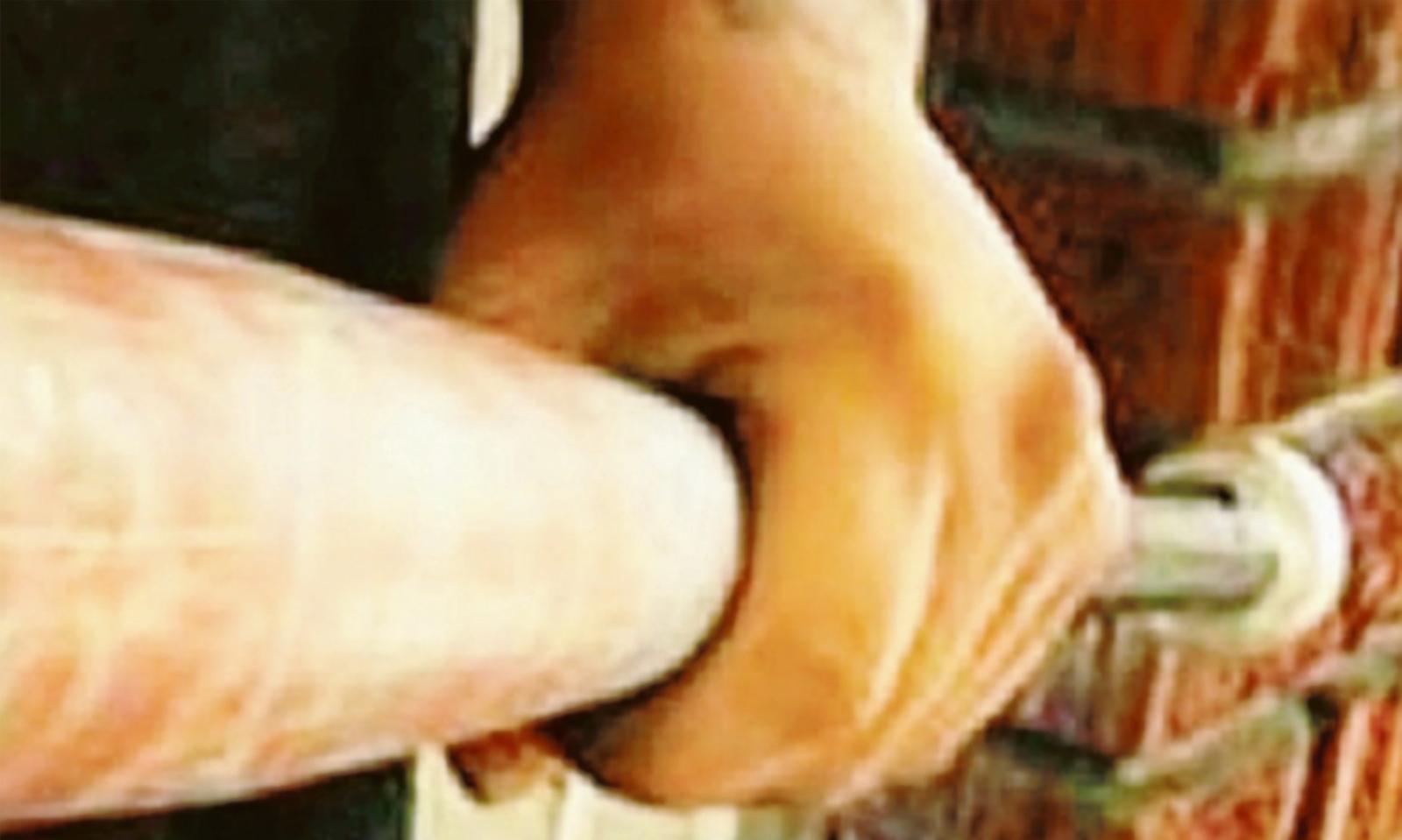 Con la mazza da baseball si accanisce sul fratello