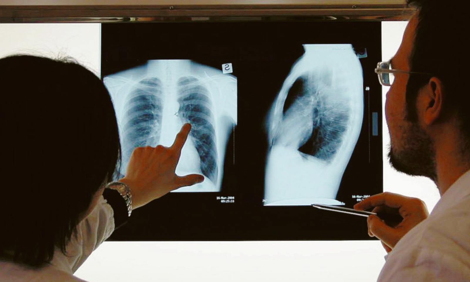 Tbc, tensione a scuola tra genitori