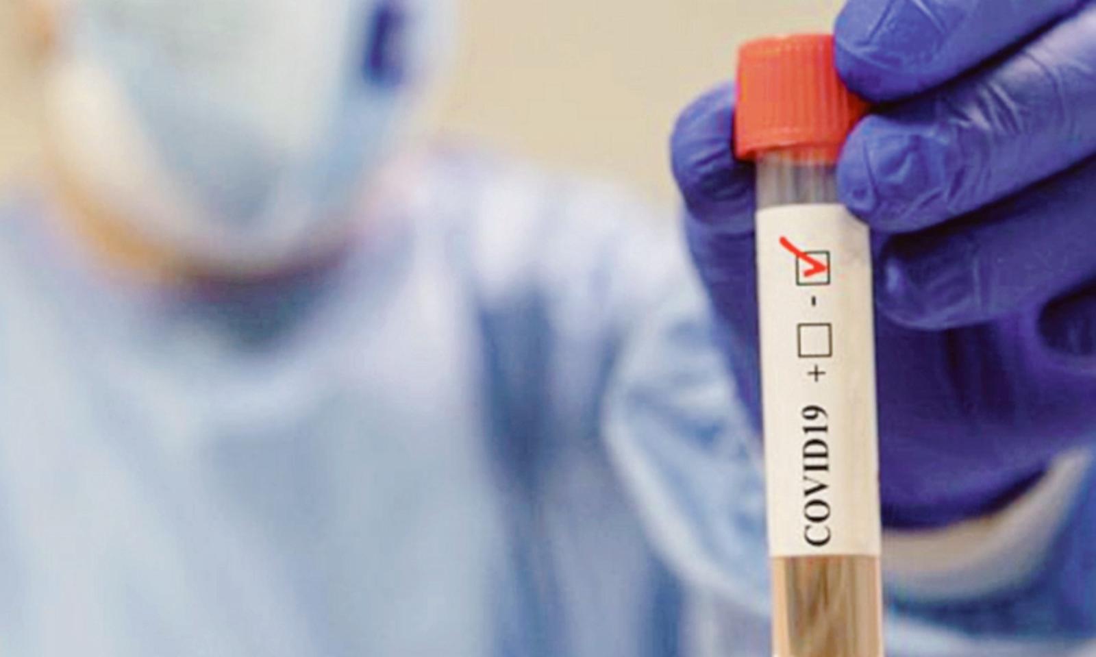 Tamponi: 170 analisi al giorno