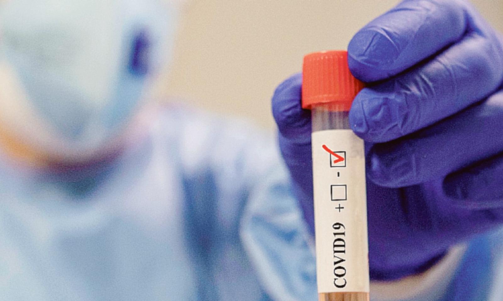 Focolai nel vicino mantovano