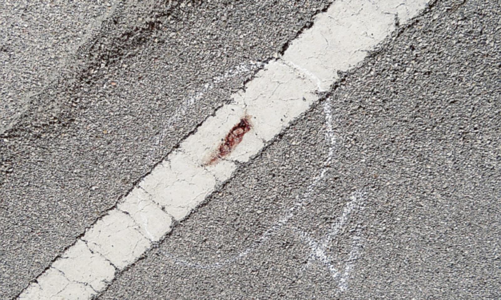 La ballerina accoltellata migliora