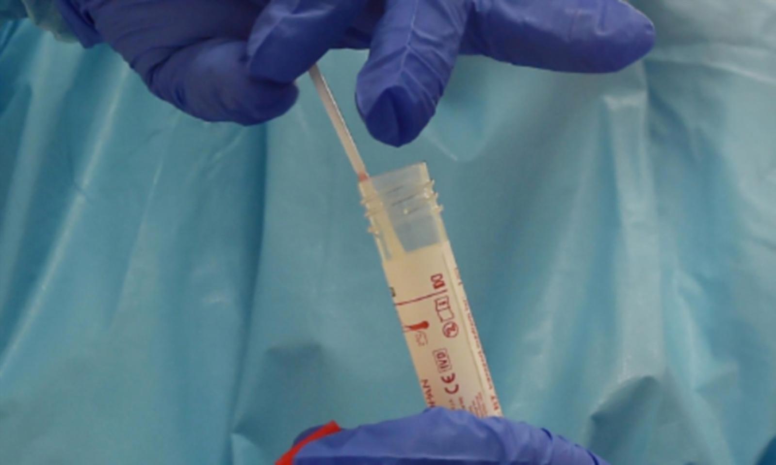 Covid, guarigioni che danno speranza