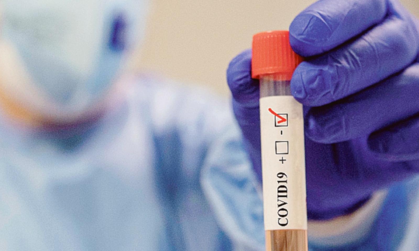 Il contagio ora appare in calo