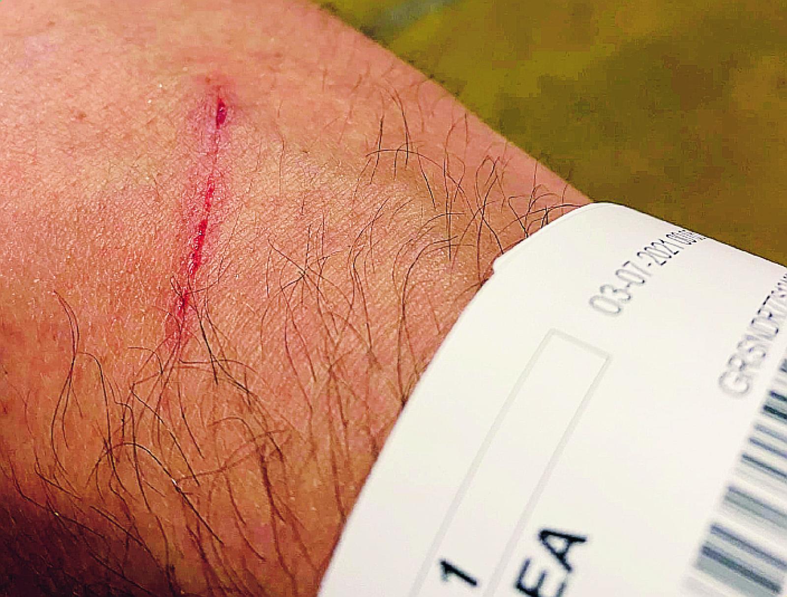 Ferisce vicesindaco e aggredisce poliziotto, 21enne condannato