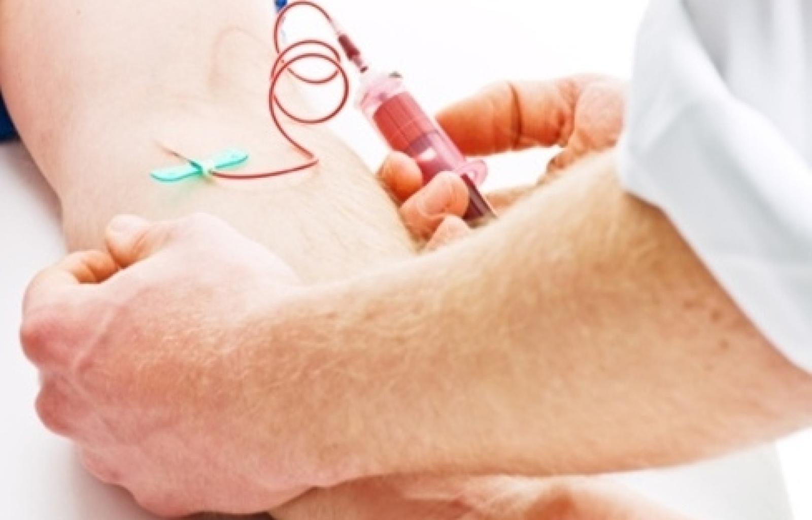 Analisi del sangue solo su prenotazione