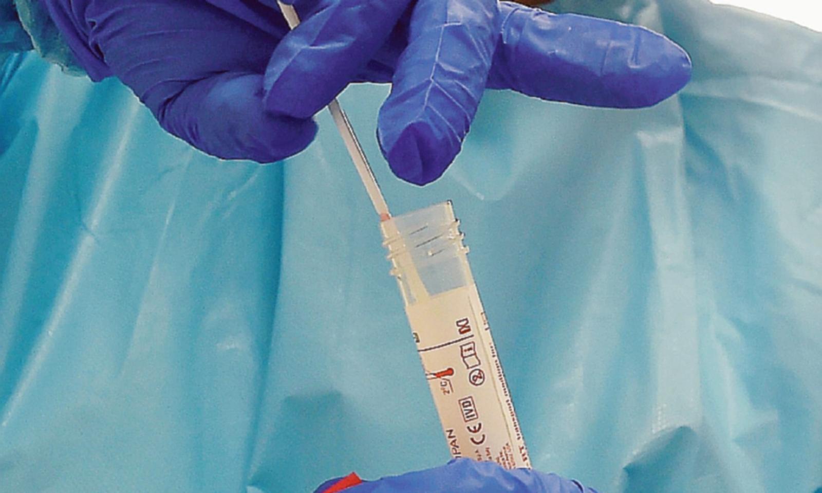 Covid 19, impennata di positivi