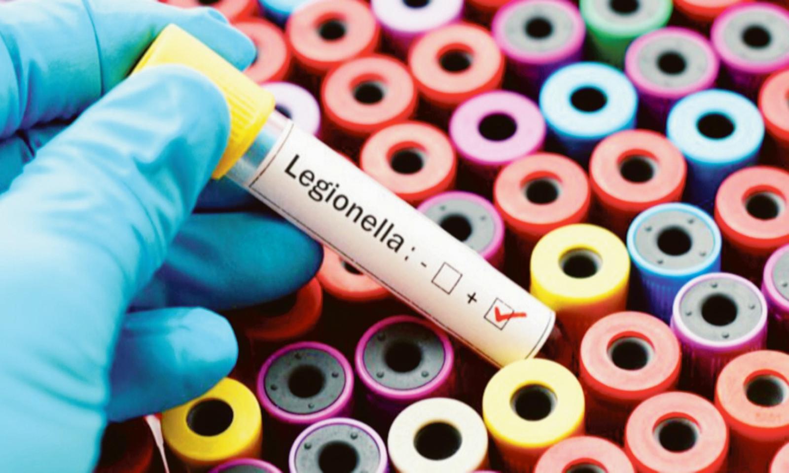 Scatta la guerra alla legionella