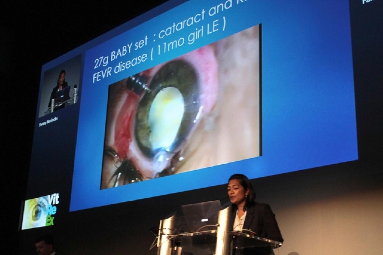 Vitrex Convegno Oculistica CenSer 17