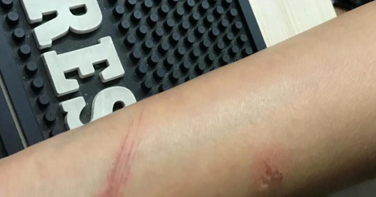 Tentato stupro alle giostre. L'aggressore rischia il linciaggio 