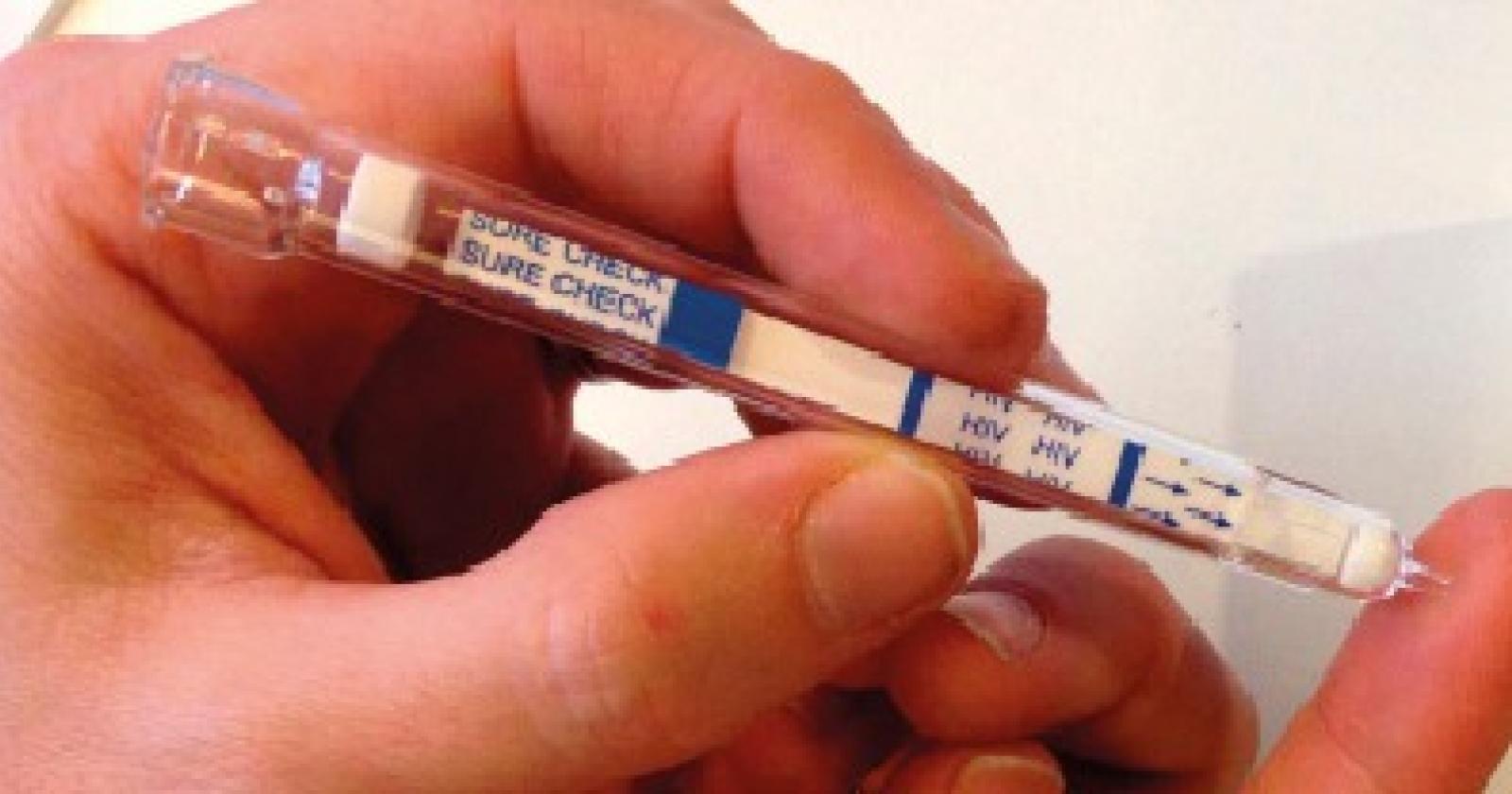La compagna gli nasconde che ha l’Hiv, lui lo scopre dopo 7 anni e la denuncia
