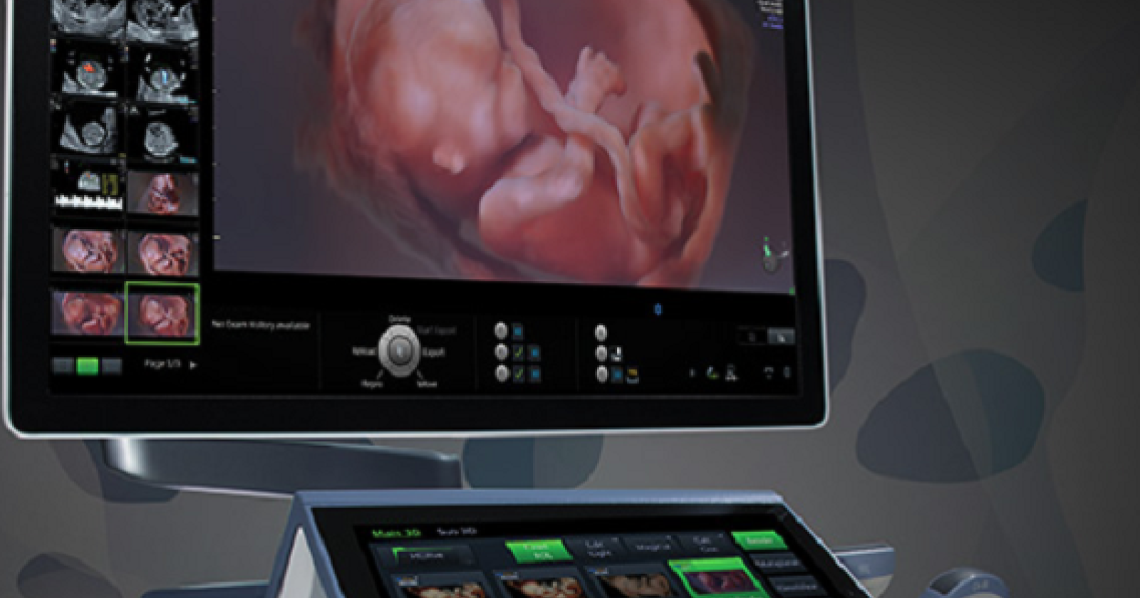 "Ecco come vediamo il cuore del bimbo nella pancia della mamma"
