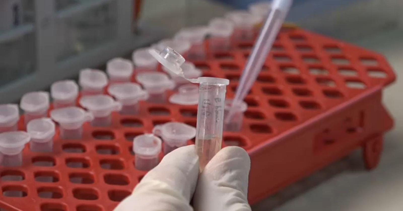 Malaria, cavarzerano ricoverato a malattie infettive