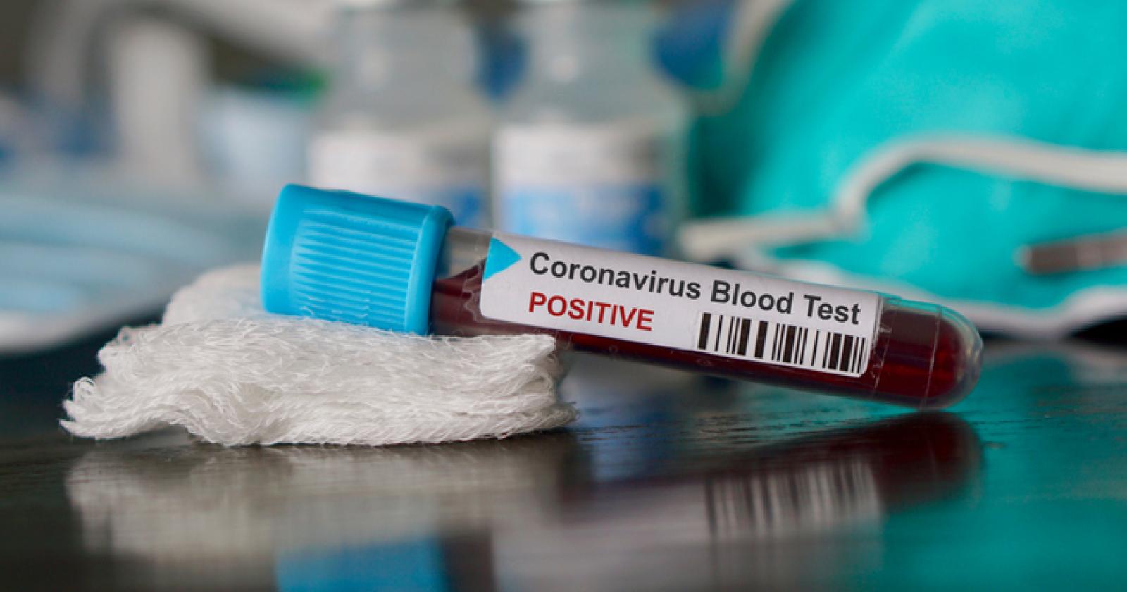 Nuovo contagio a Vo' nel focolaio che pareva spento