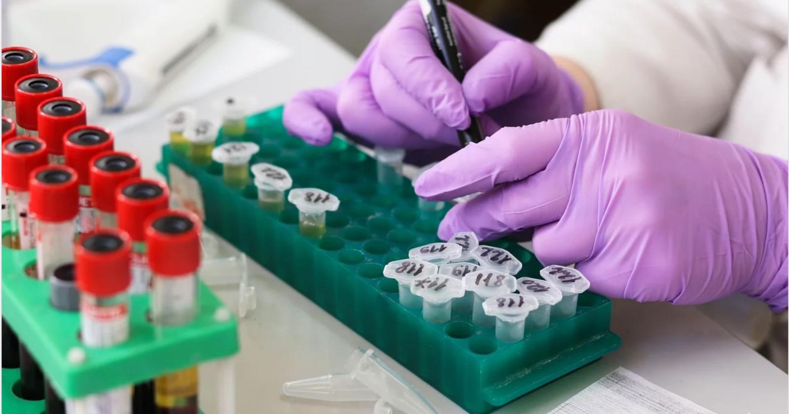 Coronavirus: 40 contagi in mezza giornata, in Veneto sono 263