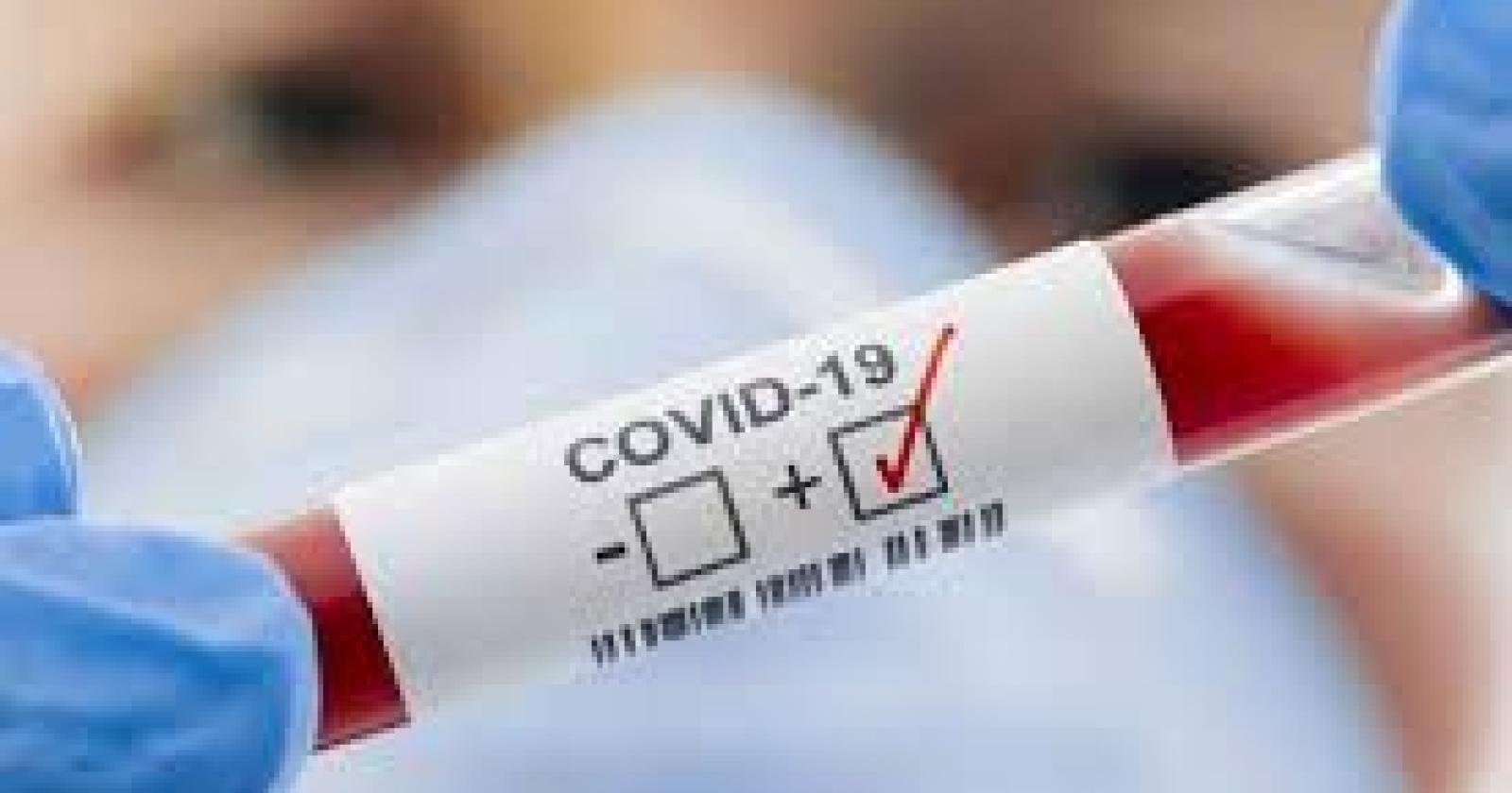 Coronavirus: "Tra una settimana, prima trasfusione di plasma immunizzato"