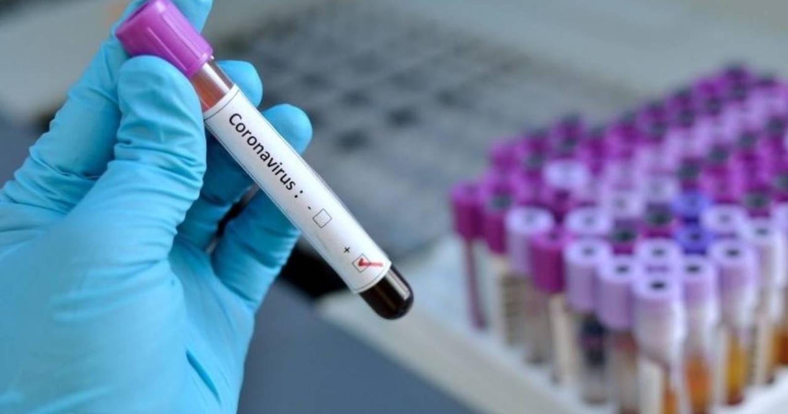 Coronavirus: "Tra una settimana, prima trasfusione di plasma immunizzato"