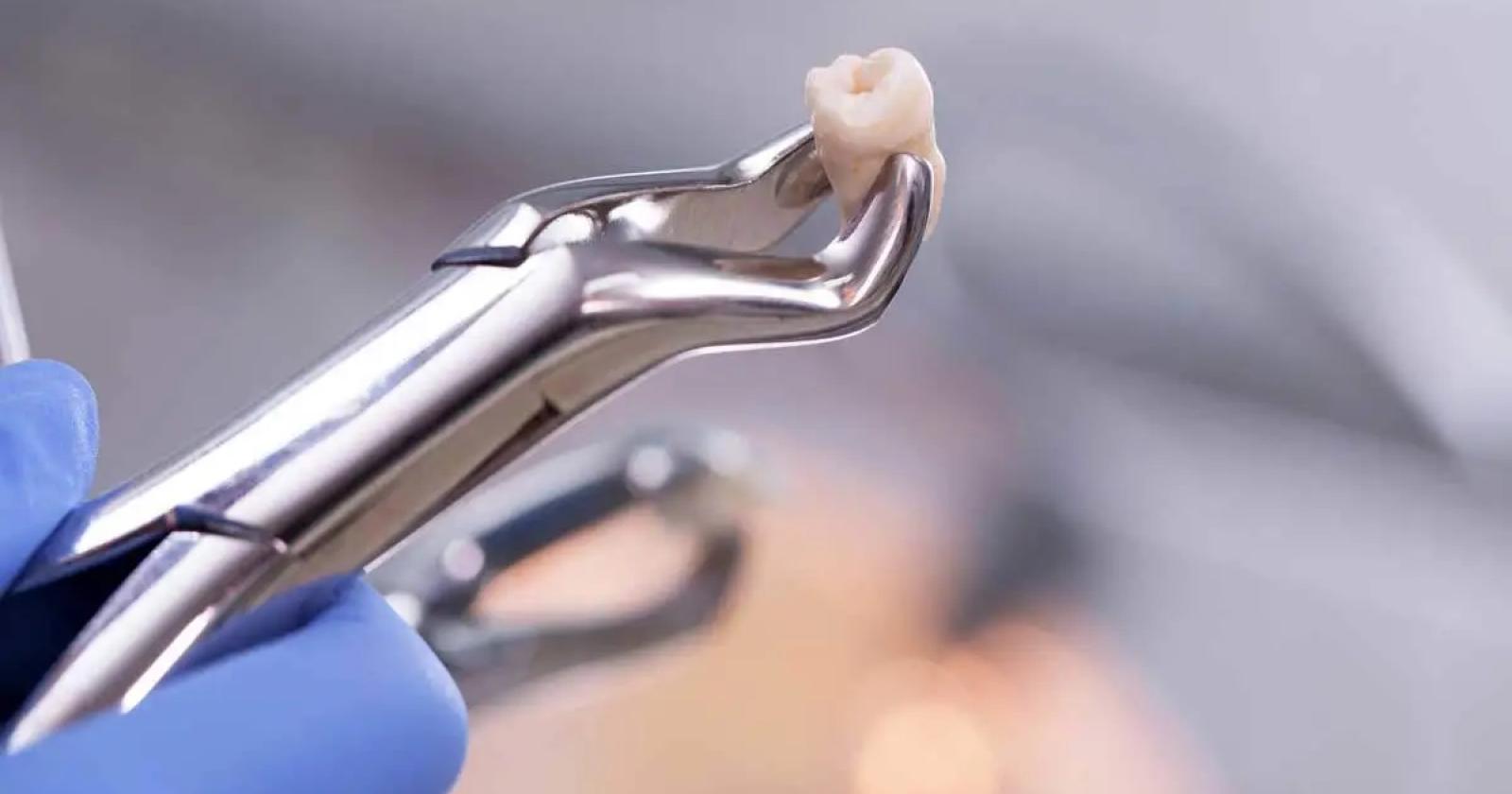 Estrae il dente sbagliato, dentista condannato