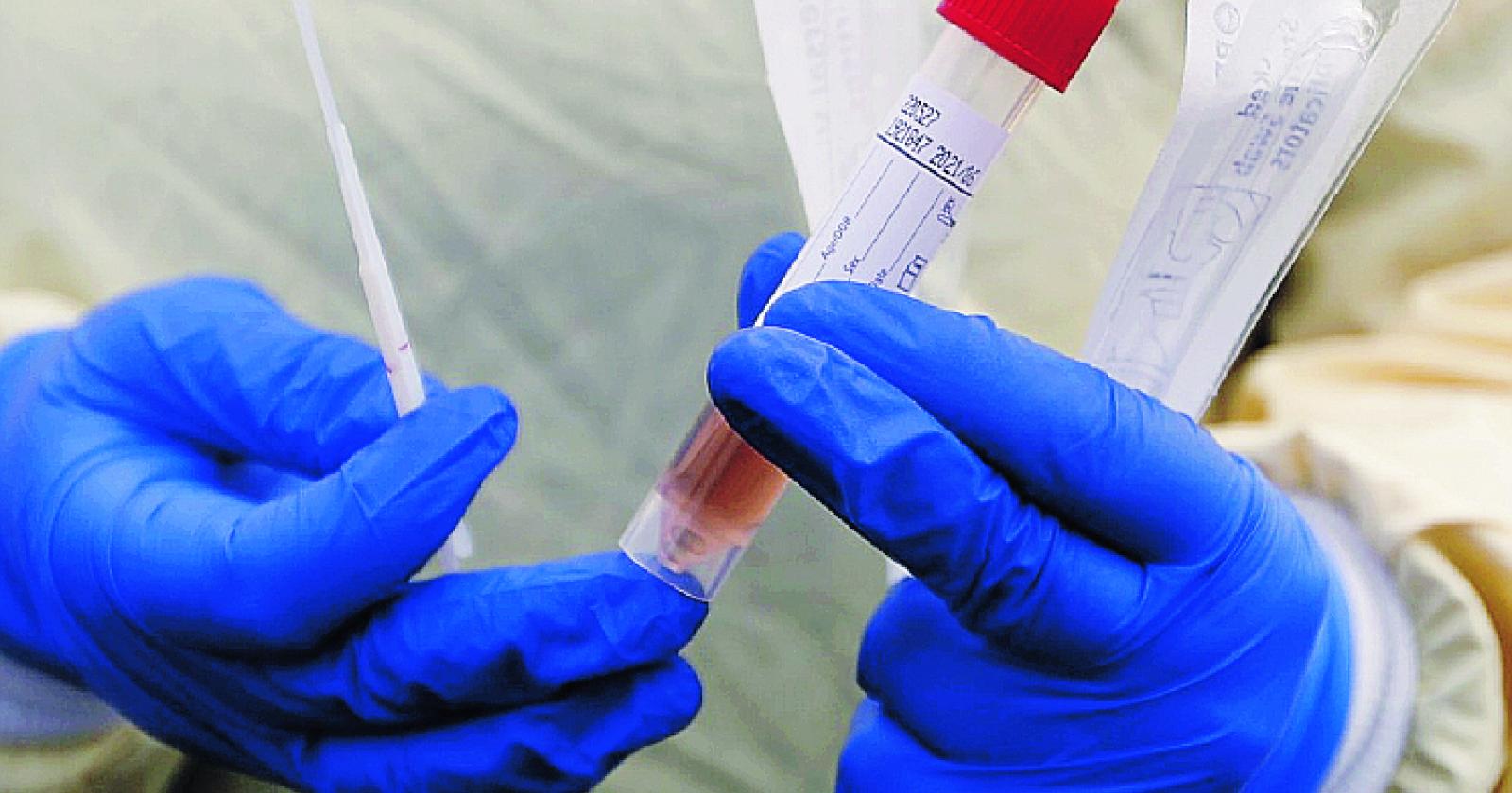 Coronavirus: Zaia, pochi tamponi disponibili. Ce li faremo da soli