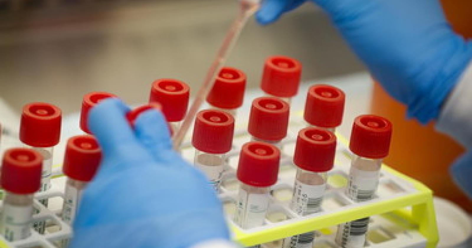 West Nile, ritorno all'incubo