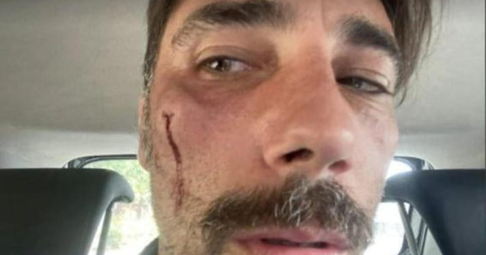 Vittorio Brumotti pestato a sangue, rapinato e minacciato