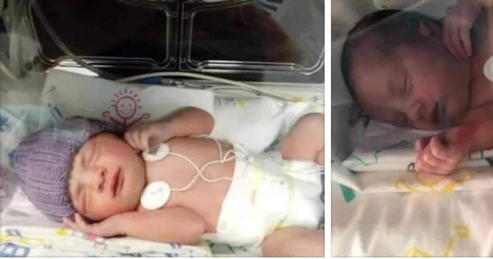 Forza piccola Chloe! Nata prematura, salvata dai medici