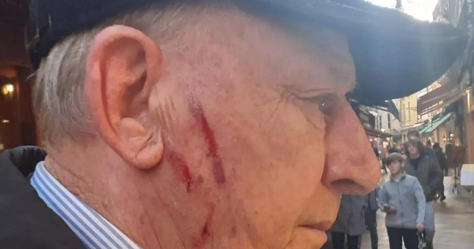 Sventa il furto, aggredito e ferito dalle giovani ladri